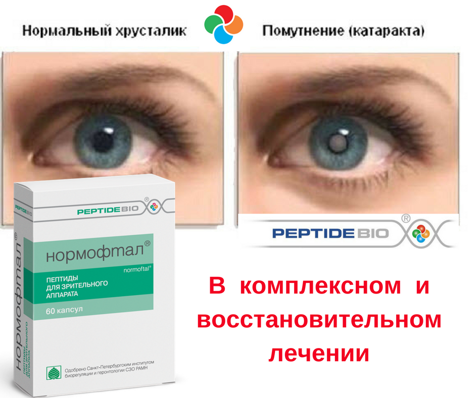 Окоспас капли отзывы врачей. Пептидные биорегуляторы препараты для глаз. Витамины для глаз для сетчатки глаза. Пептиды для глаз капли.